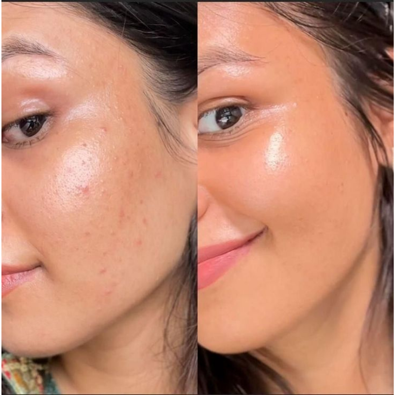 Bio-Collagen Mask - Zayane.Co™